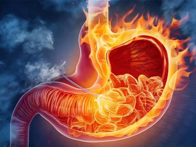 Quiz Grandes erreurs scientifiques : Il avala lui-même une culture d'Helicobacter pylori et développa une gastrite